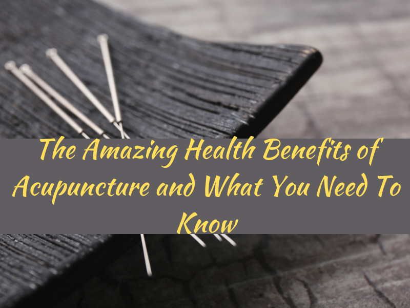 The Amazing Health Benefits of Acupuncture and What You Need To Know
